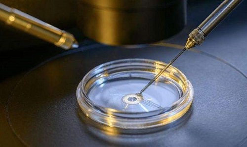从安全性与科学性角度探讨，美国试管婴儿成功率高的奥秘