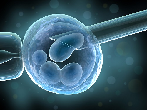 美国试管婴儿专家：输卵管囊肿对移植有影响吗？